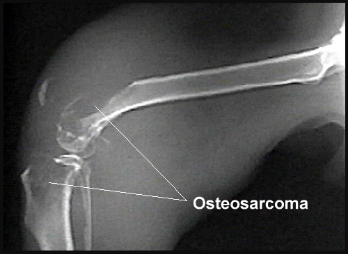 what is dog osteosarcoma
